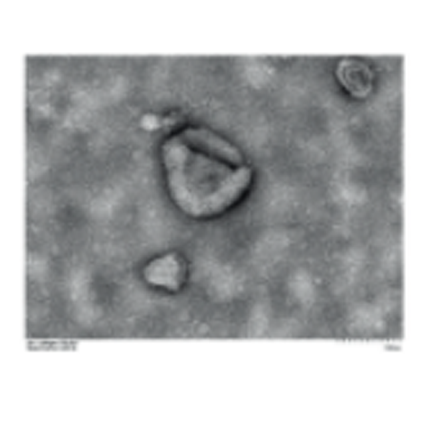 外泌体研究整体服务