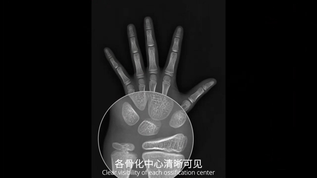 海南國(guó)產(chǎn)X射線骨齡儀哪些牌子好 歡迎咨詢 杭州安智康生物科技供應(yīng)