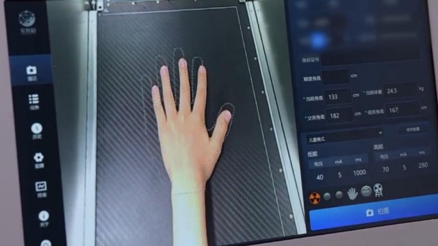 山西國內X射線骨齡儀采購 歡迎來電 杭州安智康生物科技供應