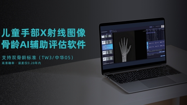 广东儿童手部X射线图像骨龄AI辅助评估软件一般多少钱,儿童手部X射线图像骨龄AI辅助评估软件