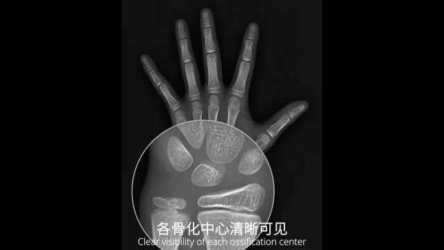 骨龄机骨龄检测仪哪里有卖的