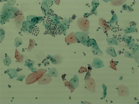 E-Prep液基細胞保存液(非婦科)