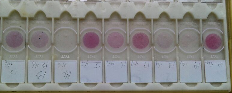 E-Prep液基細胞保存液(非婦科)