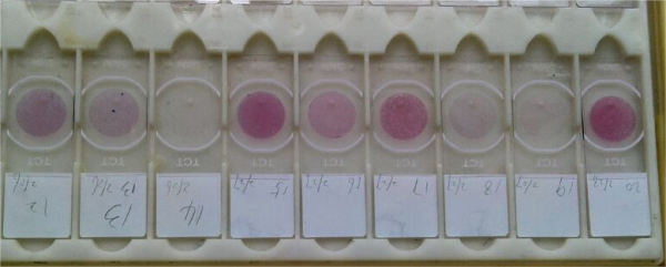 E-Prep液基細胞保存液(非婦科)