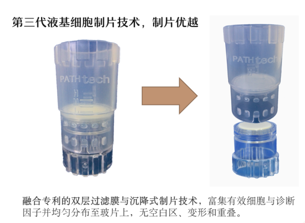 E-PREP液基細(xì)胞制片系統(tǒng)