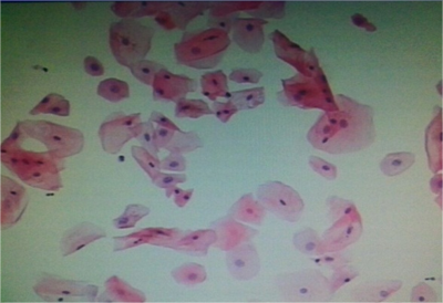 E-Prep液基細(xì)胞保存液(婦科)