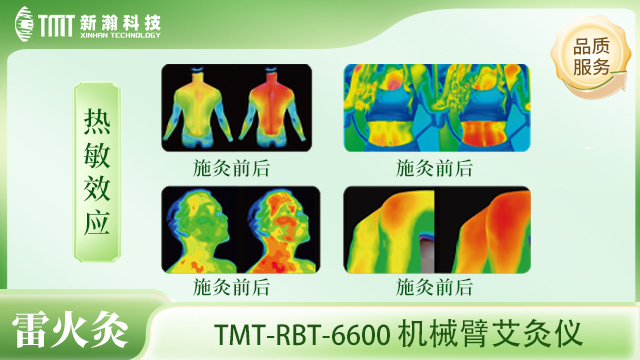 附近哪里有机械臂艾灸仪功能,机械臂艾灸仪