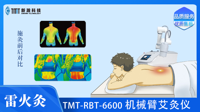現(xiàn)代機(jī)械臂艾灸儀功效 杭州新瀚光電科技供應(yīng);