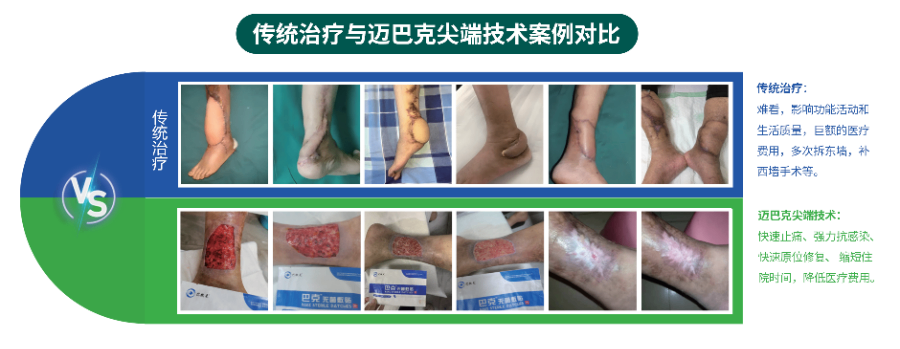 组织细胞原位再生修复术后伤口高新技术企业,原位再生修复
