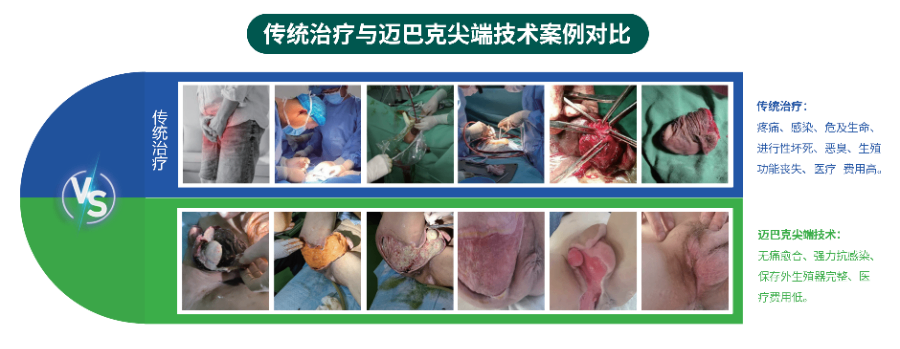 不截肢伤口不愈合产品医用皮肤护理膏,难愈合创面修复