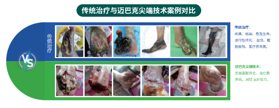 烧烫伤巴克无菌敷贴生产厂家,巴克无菌敷贴