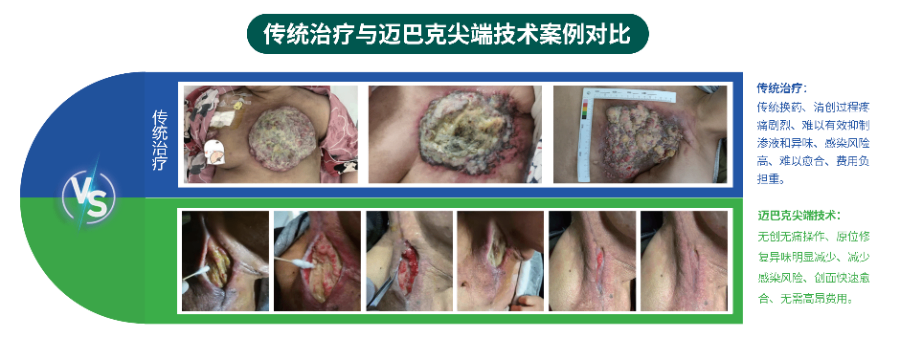 组织细胞原位再生修复难愈合伤口高新技术企业,原位再生修复
