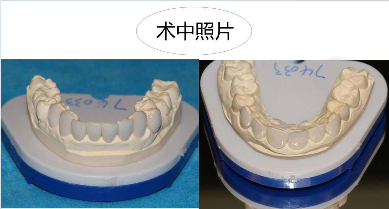 昆明牙齿矫正怎么选？专业正畸机构需要具备哪些条件