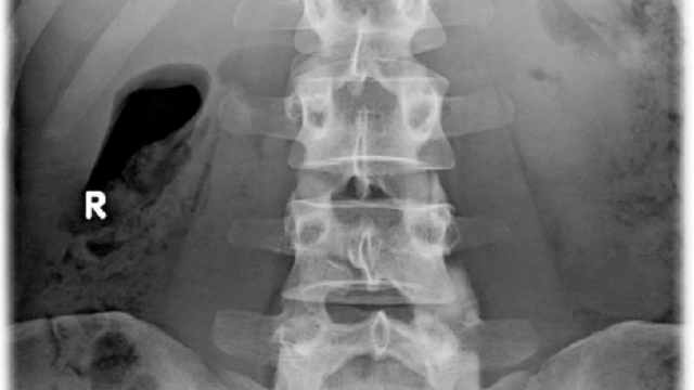 上海智能化保膽取石解決方案供應(yīng) 南京萬灃生物醫(yī)學(xué)供應(yīng)