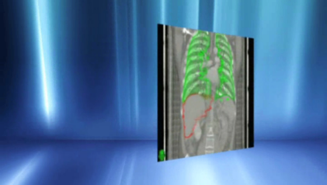 進(jìn)口精細(xì)放療（金標(biāo)）有幾種 南京萬灃生物醫(yī)學(xué)供應(yīng)