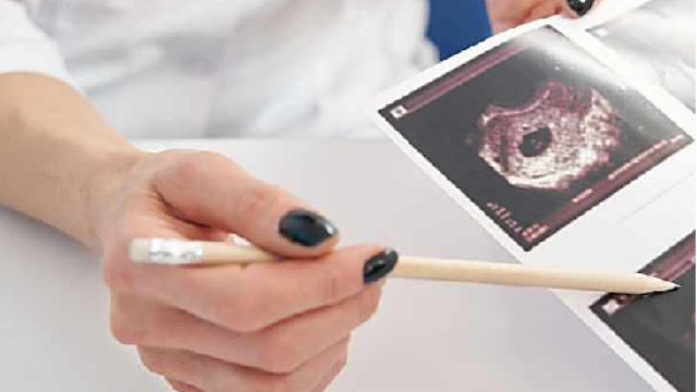 江蘇國內(nèi)結(jié)節(jié)?？平鉀Q方案哪里有 南京萬灃生物醫(yī)學(xué)供應(yīng)