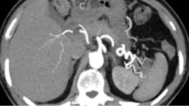 浙江標(biāo)準(zhǔn)結(jié)石臨床解決方案成本價(jià) 南京萬(wàn)灃生物醫(yī)學(xué)供應(yīng)