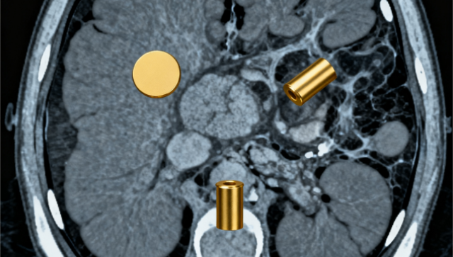 如何選精細(xì)放療(金標(biāo))一般多少錢 南京萬灃生物醫(yī)學(xué)供應(yīng)