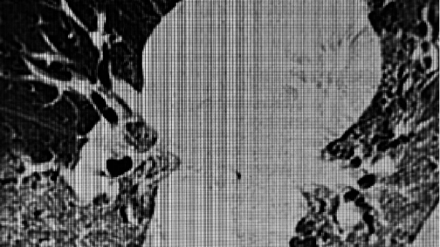 上海推薦結(jié)節(jié)?？平鉀Q方案哪家好 南京萬灃生物醫(yī)學(xué)供應(yīng)