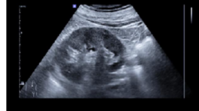 上海標(biāo)準(zhǔn)保膽取石解決方案報(bào)價(jià) 南京萬(wàn)灃生物醫(yī)學(xué)供應(yīng)