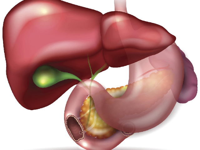 浙江什么是保膽取石解決方案方案 南京萬灃生物醫學供應