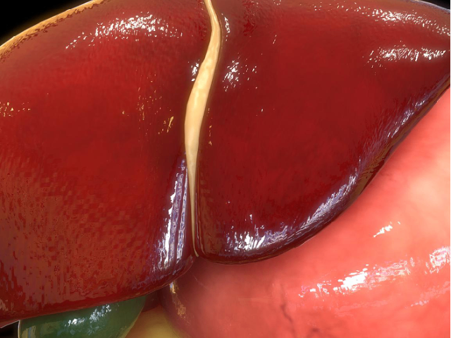 安徽常用保膽取石解決方案怎么樣 南京萬灃生物醫(yī)學(xué)供應(yīng)