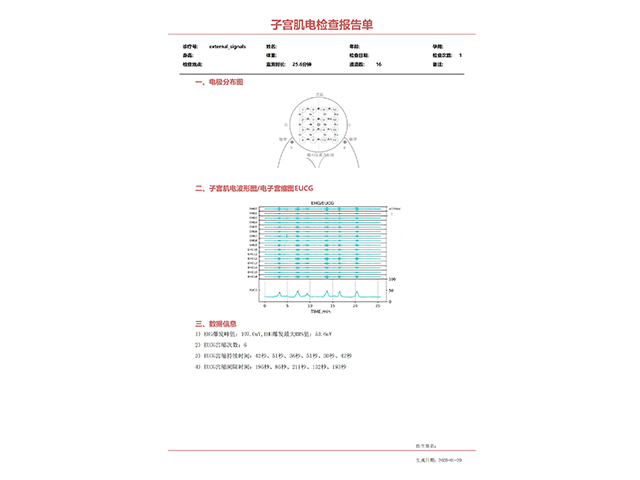 江蘇穿戴式子宮肌電監(jiān)測儀哪里可以買到