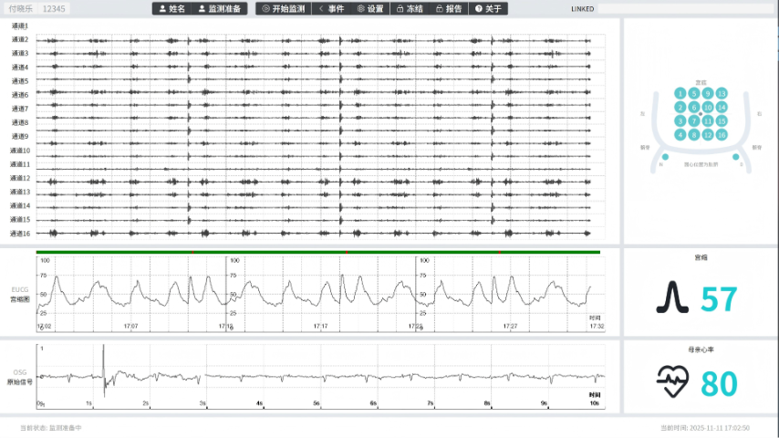 上海多點位子宮肌電監測儀供應商 廣州愛聽貝科技供應