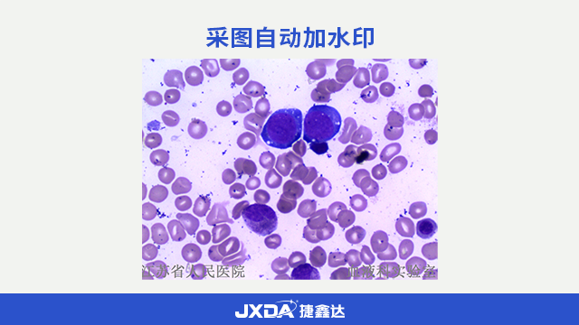 青岛细胞图文分析系统定制,细胞形态学系统