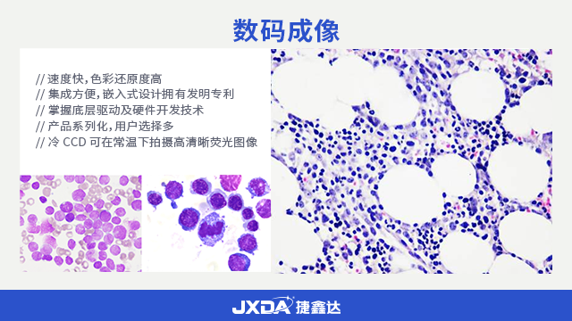 自动计数血液实验室诊断图文报告系统分析系统,细胞形态学系统