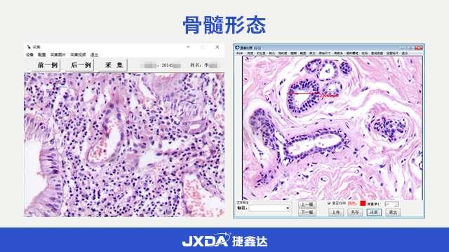自动计数血液实验室诊断图文报告系统分析系统,细胞形态学系统