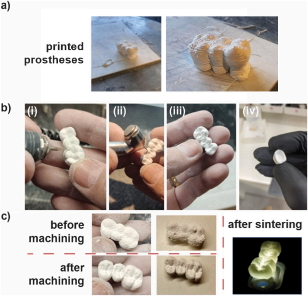 學(xué)術(shù)分享丨DIW墨水直寫3D打印半透明氧化鋯牙假體