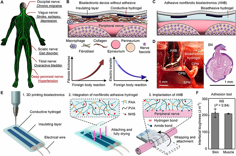 學(xué)術(shù)分享 I 利用3D打印制備粘附性非纖維化生物電子界面，實(shí)現(xiàn)多樣化外周神經(jīng)的長(zhǎng)期功能神經(jīng)調(diào)節(jié)的研究