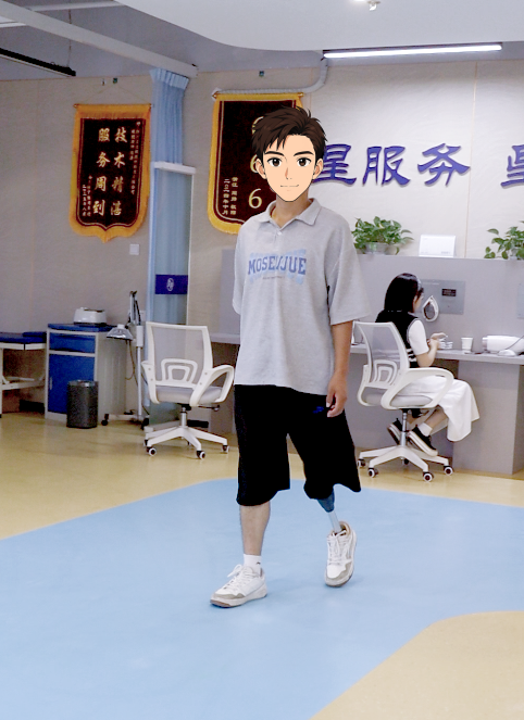 浙江星源大腿假肢