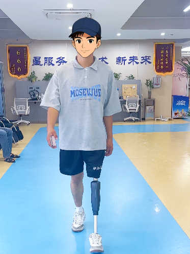 浙江星源大腿假肢