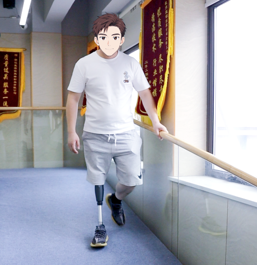 星源假肢大腿假肢下坡