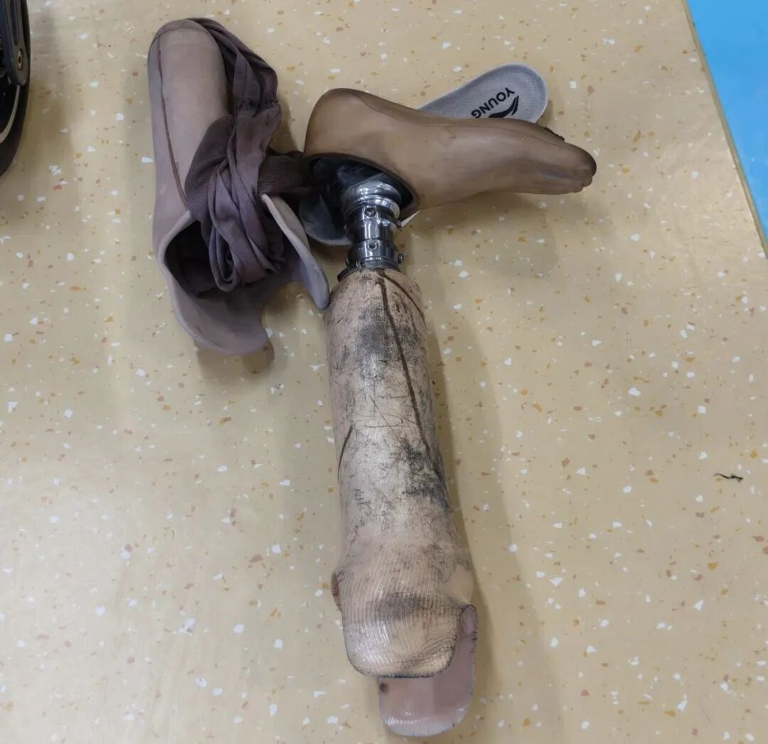 麥麥提吐爾遜江·艾爾肯的舊假肢