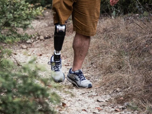 浙江大腿截肢裝大腿假肢價格查詢 歡迎來電 杭州精博康復輔具供應