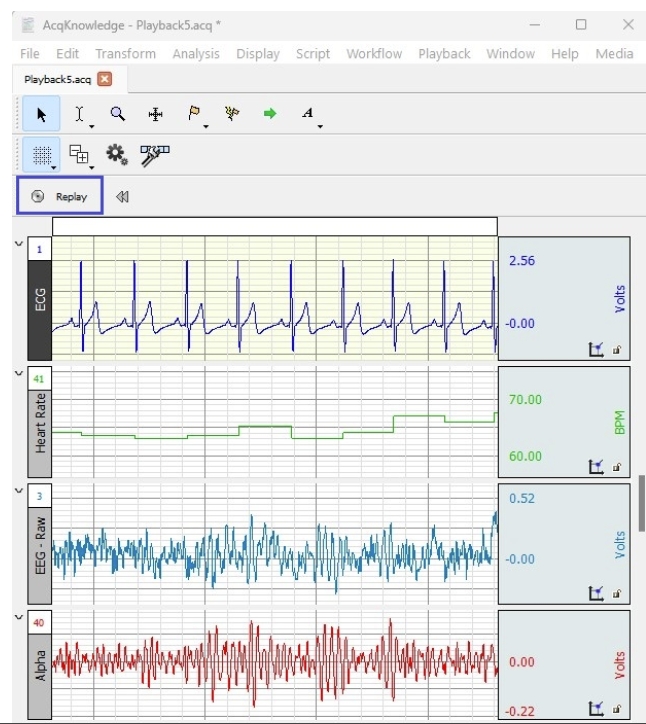 BIOPAC-AcqKnowledge 5 data acquisition and analysis software_郑小姐
