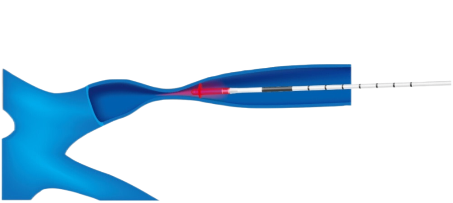 上海臨床驗證半導(dǎo)體激光治療儀 和諧共贏 上海優(yōu)福通醫(yī)療設(shè)備供應(yīng);