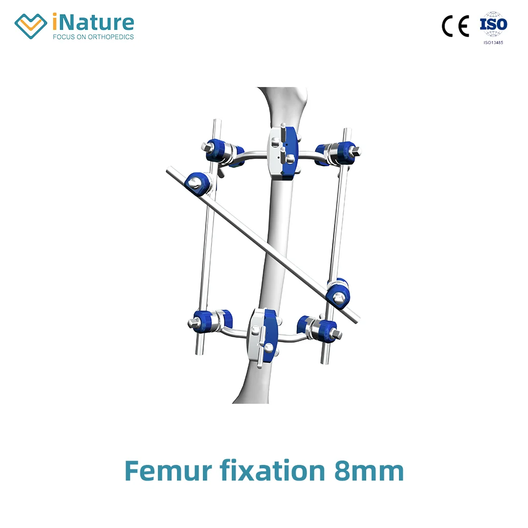 Φ8.0 Series External Fixation Fixator-| iNature - Manufacturer & Sale
