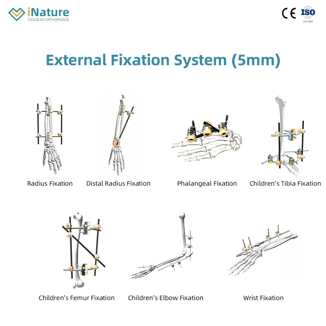 Φ5.0 Series External Fixation Fixator-| iNature - Manufacturer & Sale
