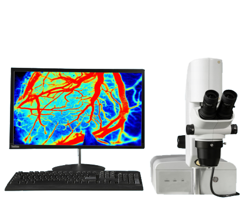 激光散斑血流成像儀