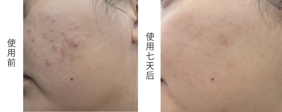 黃埔區(qū)藍(lán)銅肽舒緩蝦青素次拋精華液如何收費(fèi) 誠信經(jīng)營 同康國際生物科技供應(yīng)