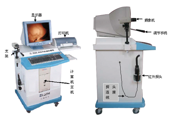 經顱多普勒超聲診斷儀