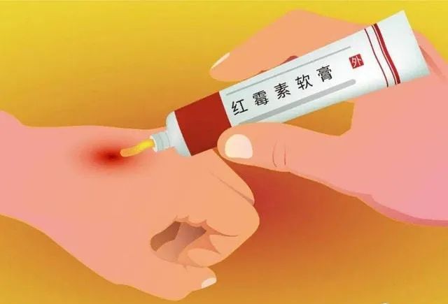 紅霉素軟膏和紅霉素眼膏的區(qū)別