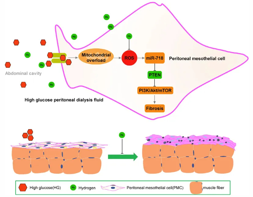 【納諾氫科研】文獻速遞⑥ |分子氫緩解腹膜透析相關(guān)的腹膜纖維化