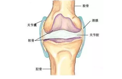 膝蓋腫脹不消？可能是滑膜炎，這些誤區(qū)要避開