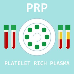 PRP療法：用自己的血修復運動損傷，真的有效嗎？