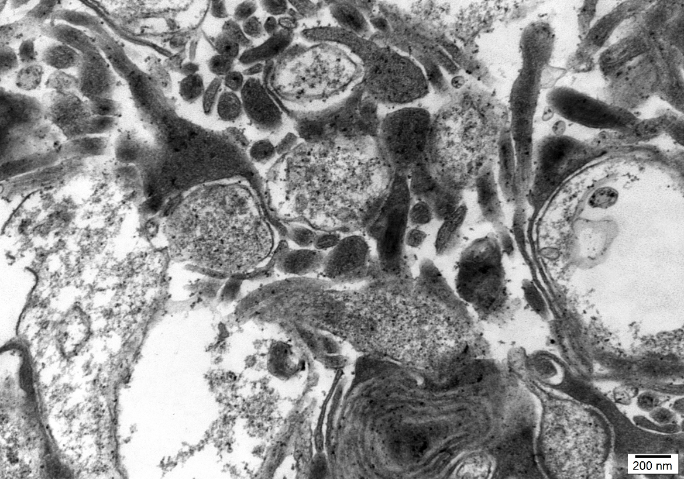 組織透射電鏡分子檢測組織透射電鏡多少錢